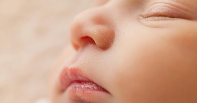 Newborn Lip Blisters